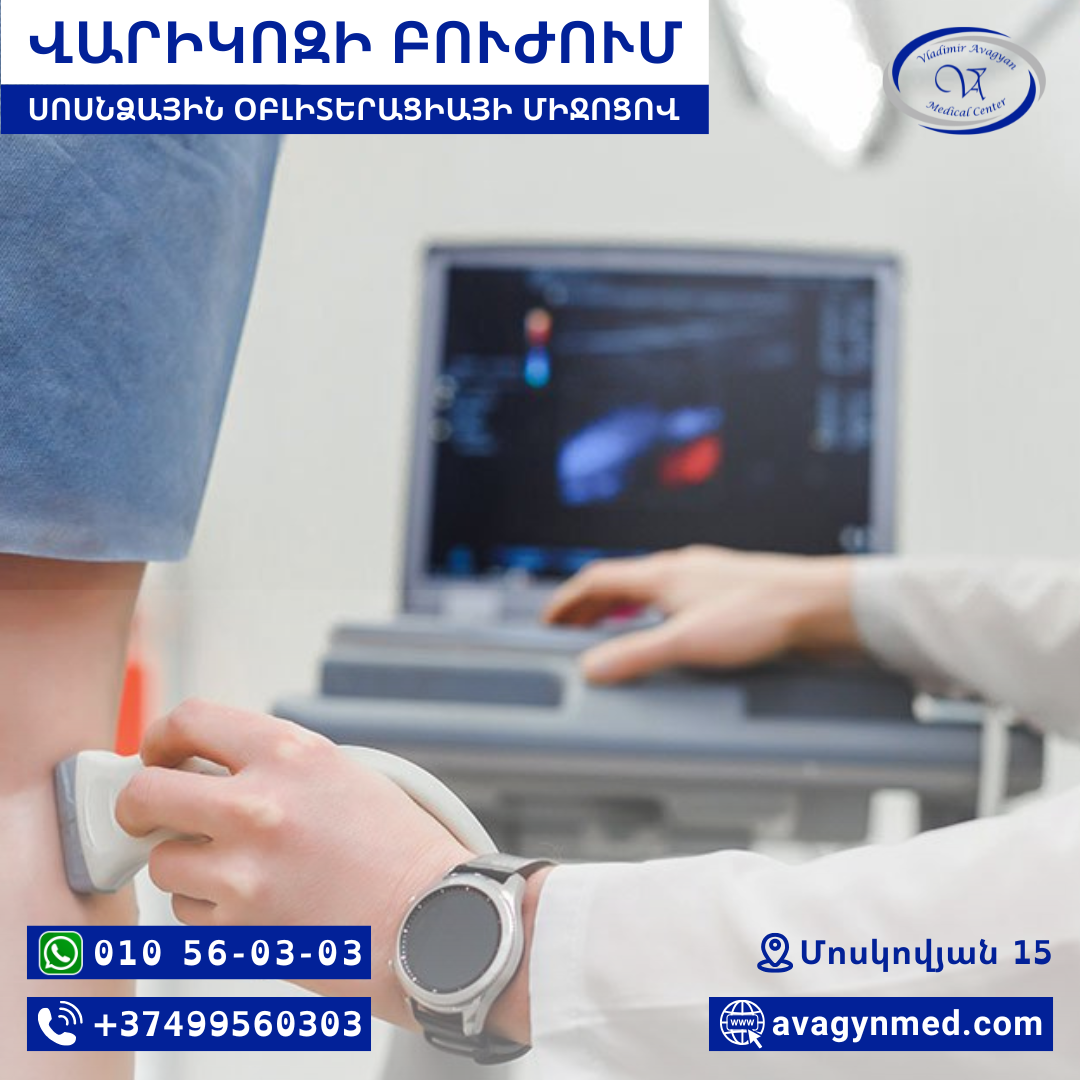 ՍՈՍՆՁԱՅԻՆ ՕԲԼԻՏԵՐԱՑԻԱ